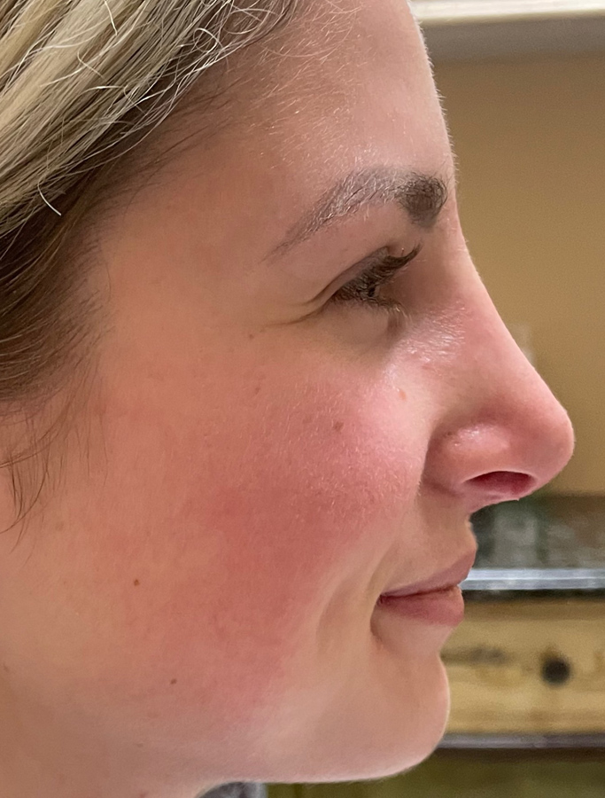 After Image: Patient Case #1669 - right-side