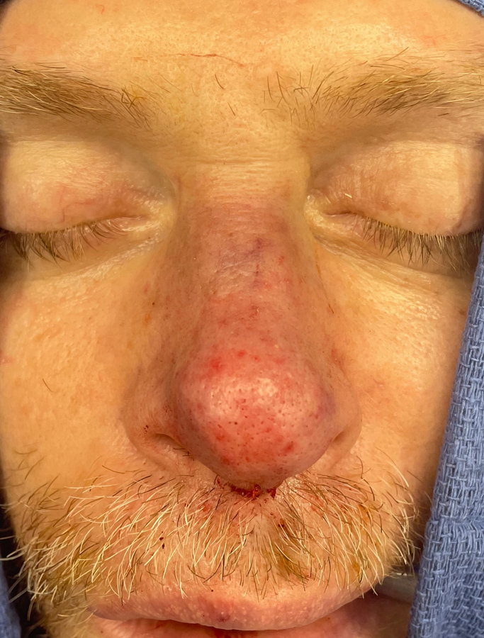 After Image: Patient Case #1672 - front