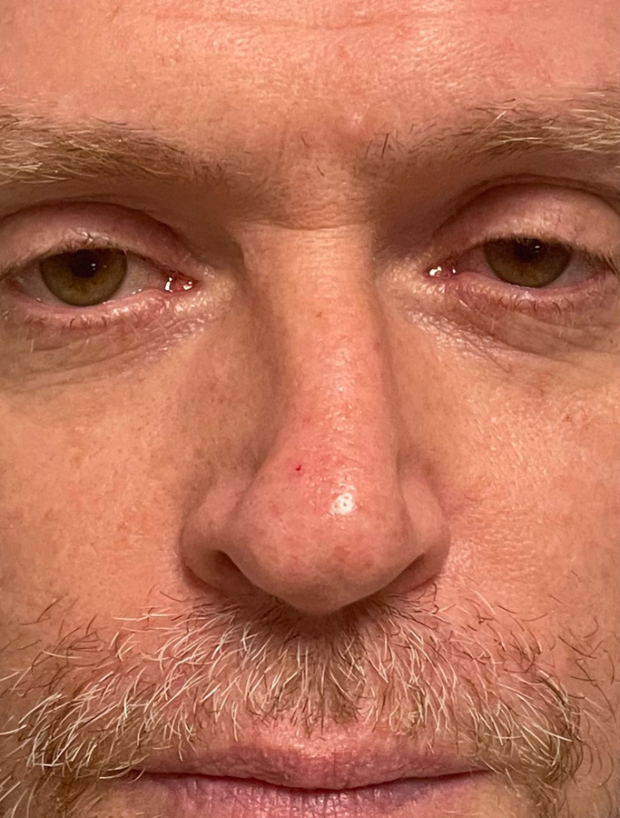 Before Image: Patient Case #1672 - front