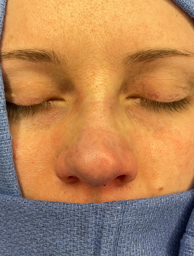 After Image: Patient Case #1673 - front