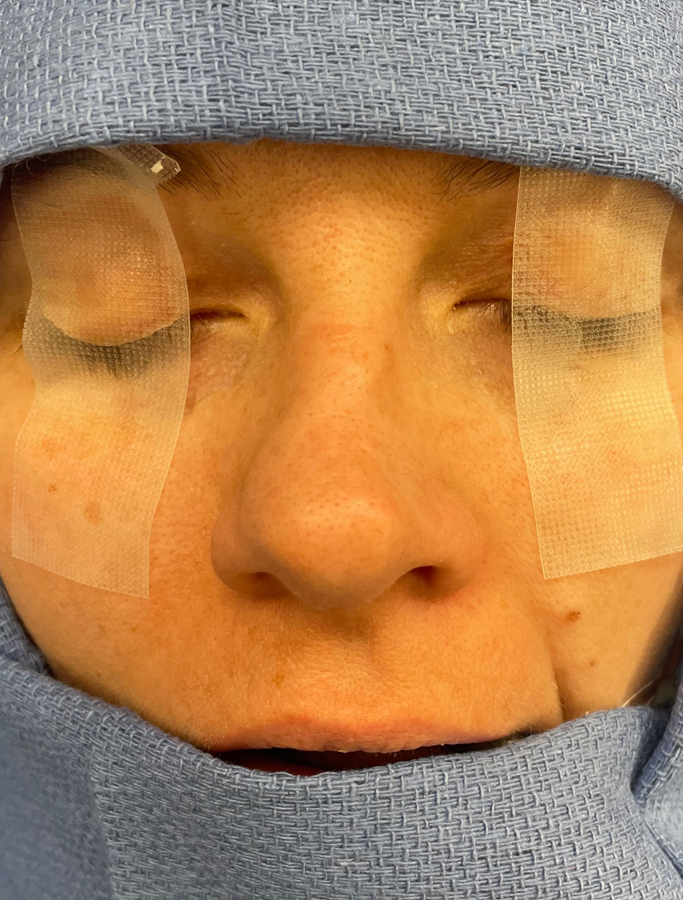 Before Image: Patient Case #1673 - front