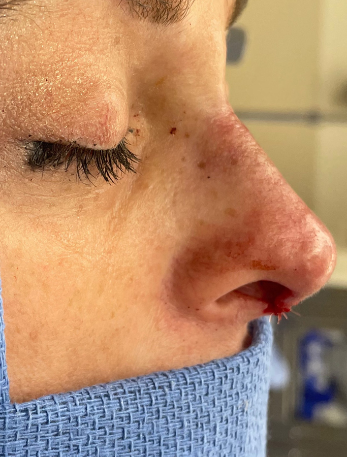 After Image: Patient Case #1675 - right-side