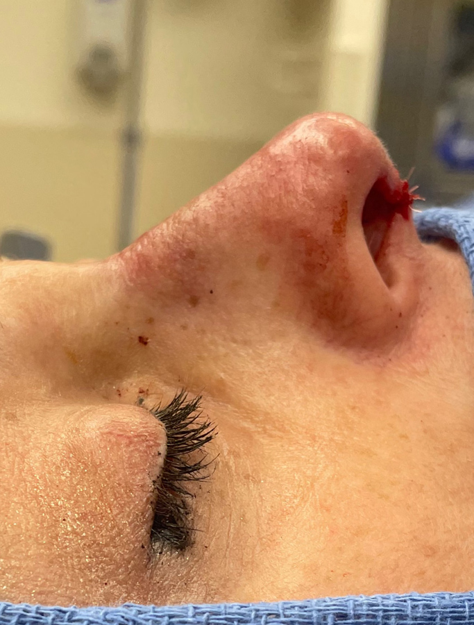 After Image: Patient Case #1675 - other