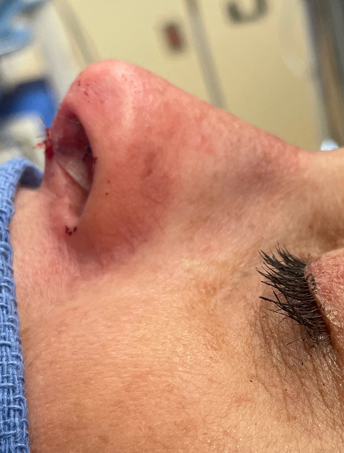 After Image: Patient Case #1675 - other