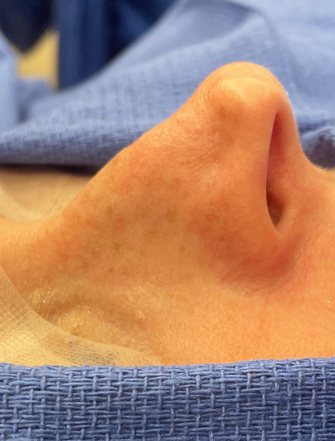 Before Image: Patient Case #1675 - other