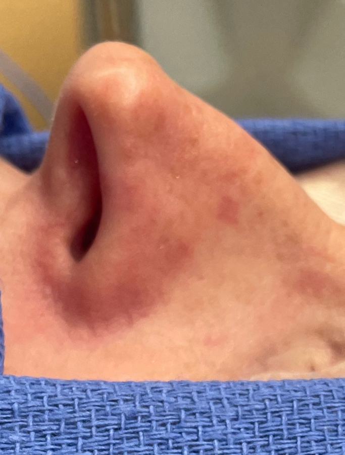 Before Image: Patient Case #1675 - other