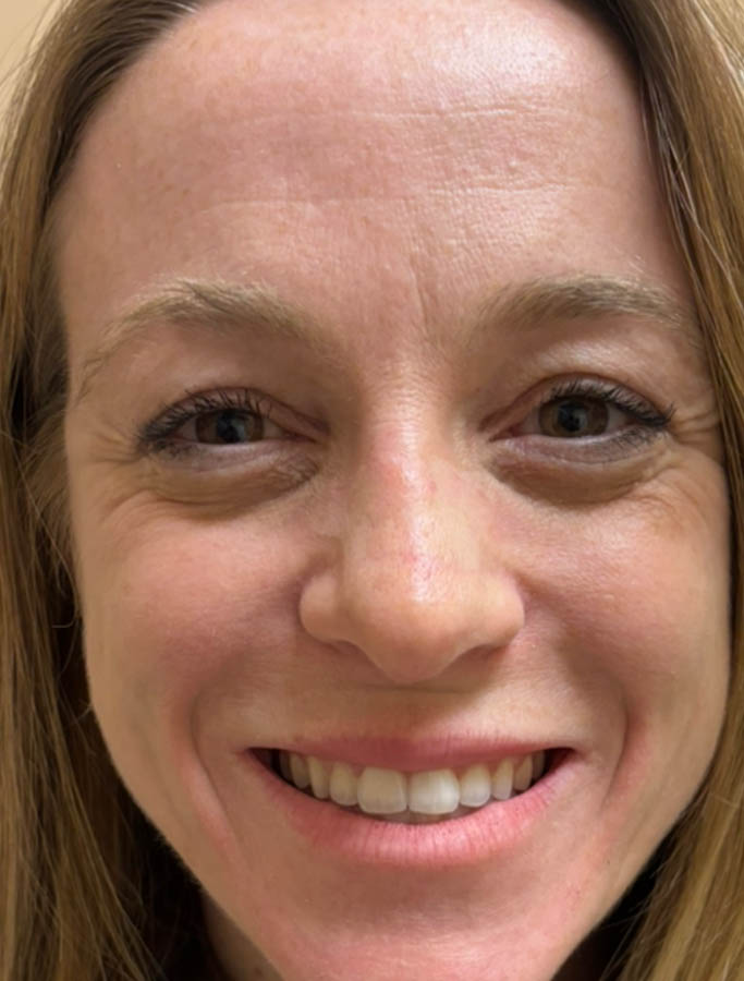 After Image: Patient Case #18132 - front