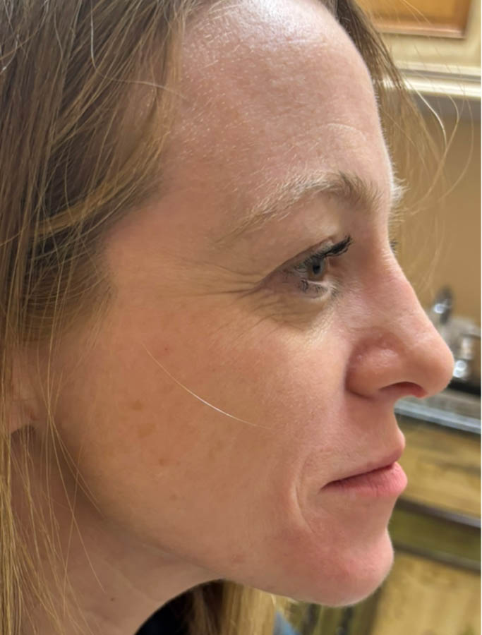 After Image: Patient Case #18132 - right-side