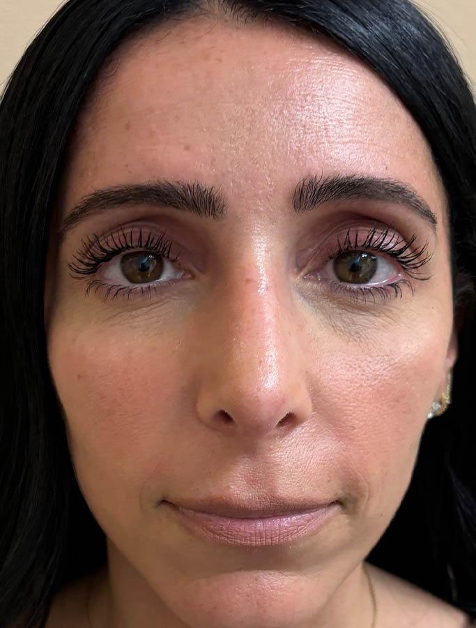 After Image: Patient Case #18139 - front