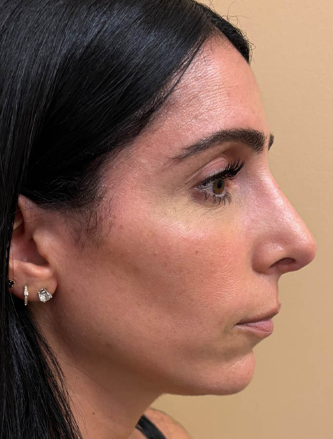 After Image: Patient Case #18139 - right-side