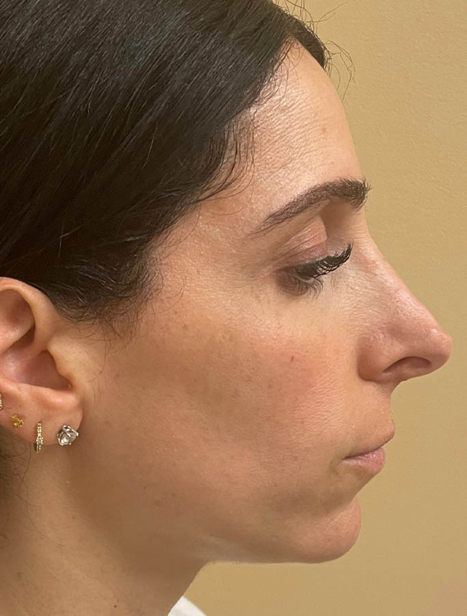 Before Image: Patient Case #18139 - right-side