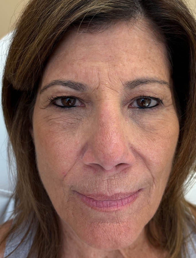 After Image: Patient Case #18146 - front