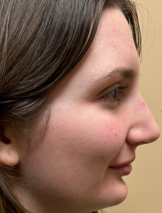 After Image: Patient Case #18165 - right-side