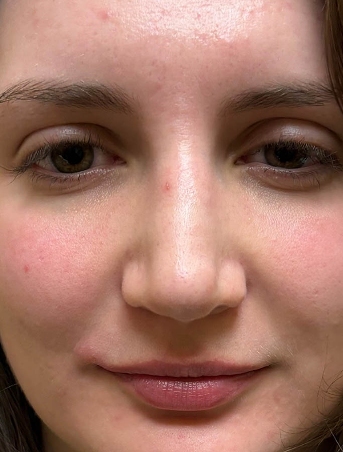 After Image: Patient Case #18165 - front