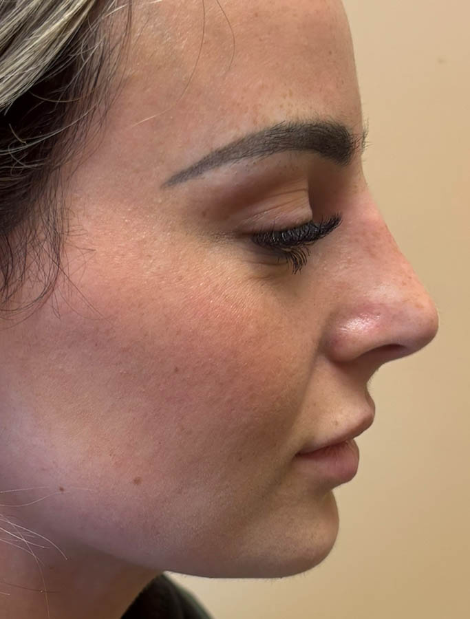 After Image: Patient Case #18648 - right-side