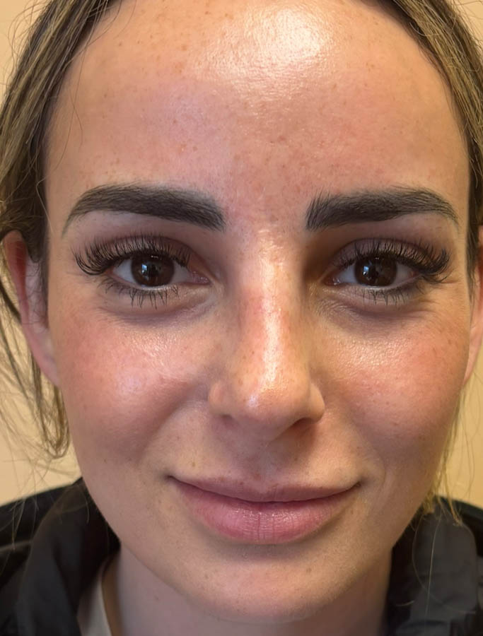 After Image: Patient Case #18648 - front