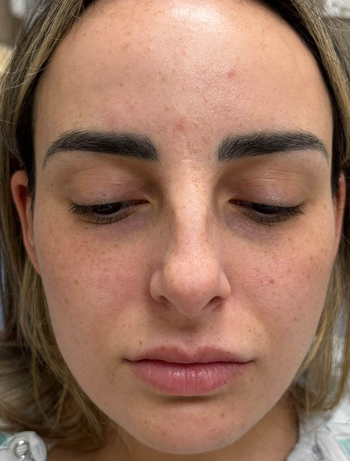 Before Image: Patient Case #18648 - front