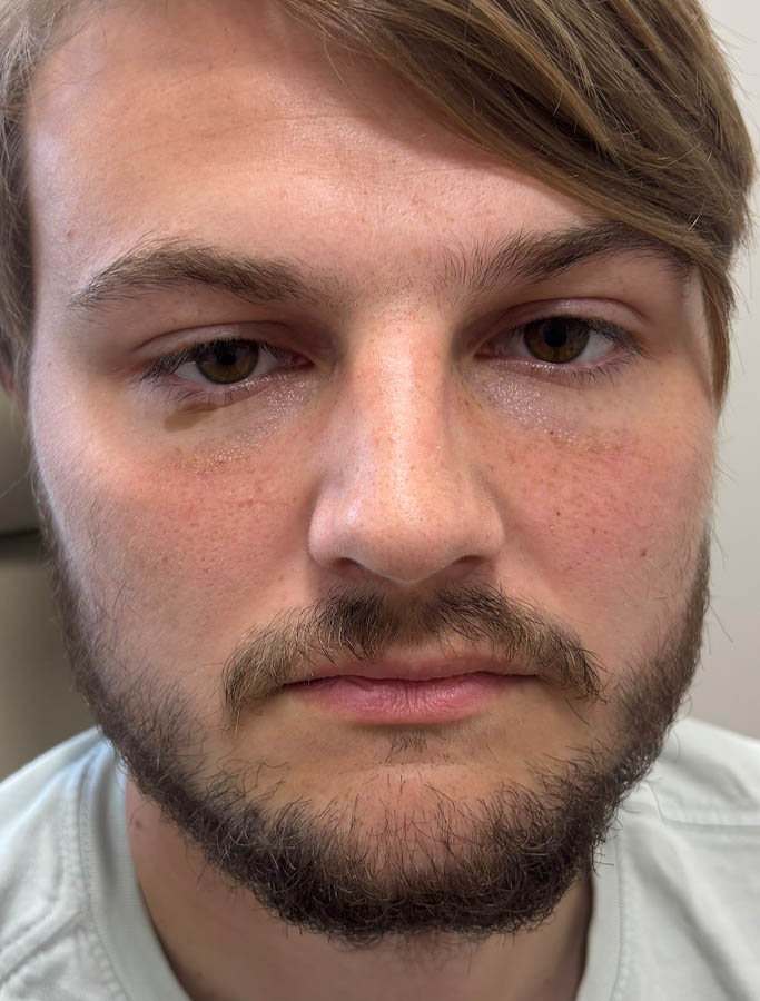 After Image: Patient Case #18666 - front