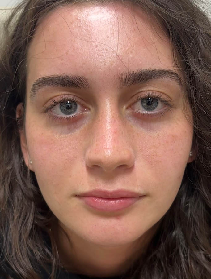 After Image: Patient Case #18669 - front