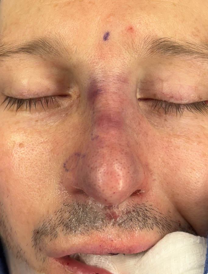 After Image: Patient Case #18672 - front