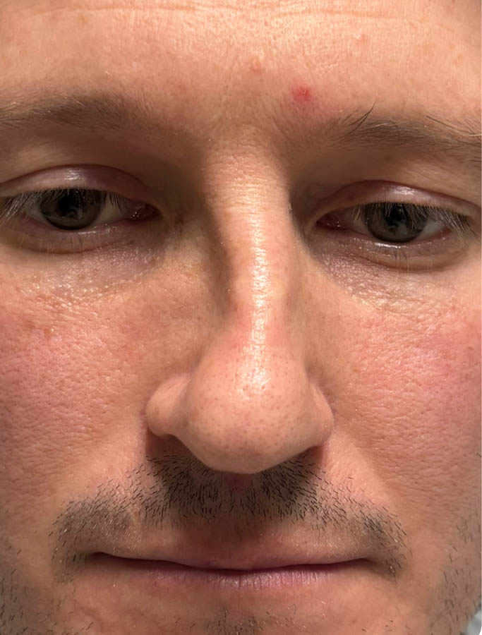 Before Image: Patient Case #18672 - front