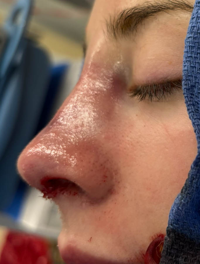 After Image: Patient Case #18675 - left-front-oblique