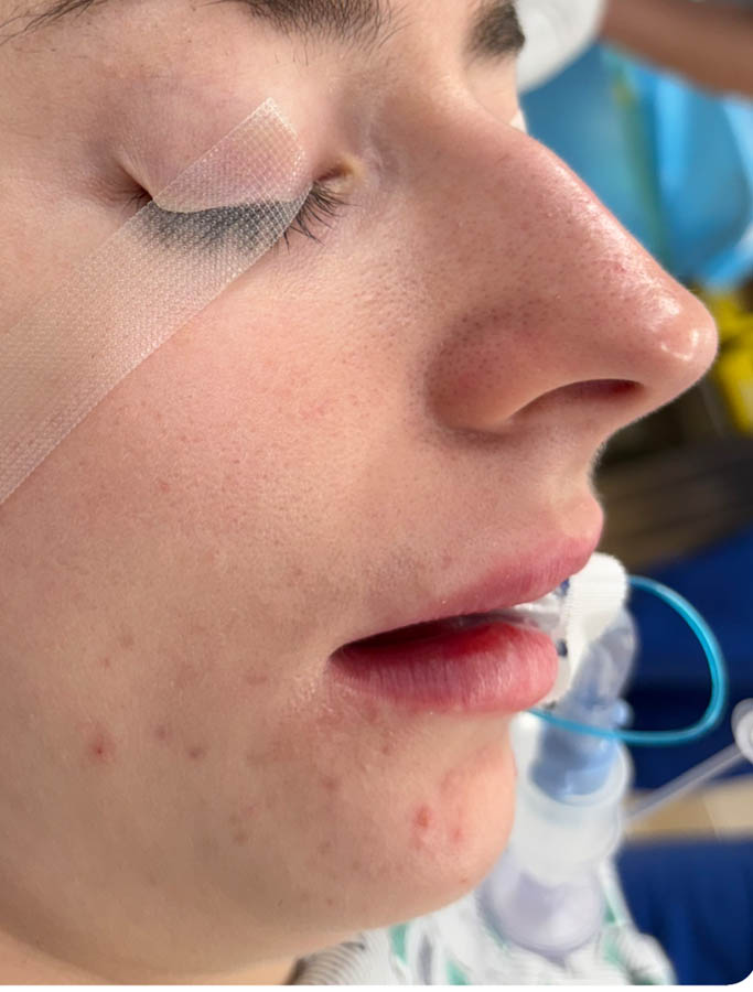 Before Image: Patient Case #18675 - right-side