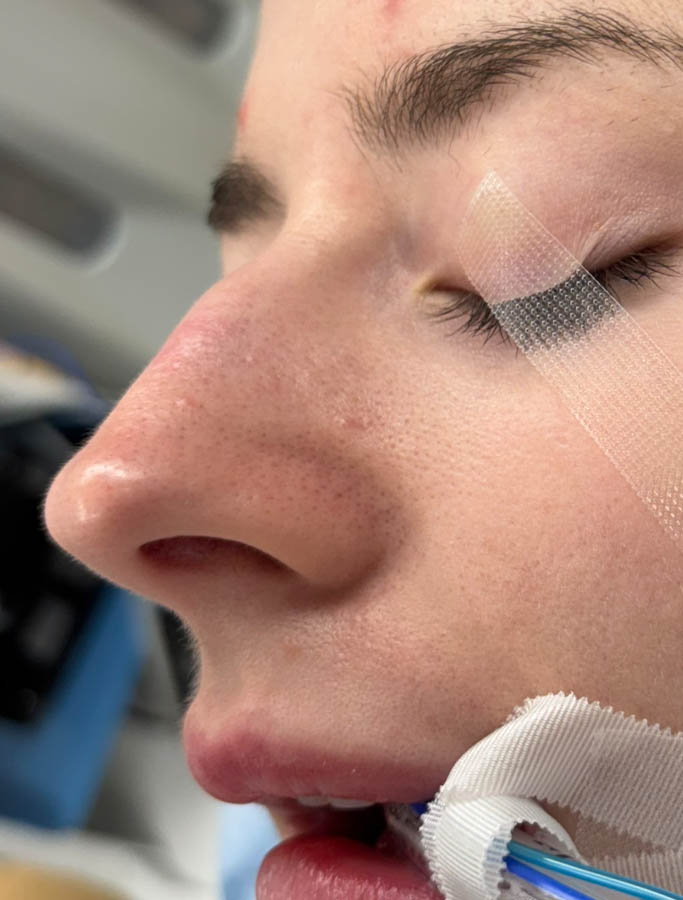 Before Image: Patient Case #18675 - left-front-oblique