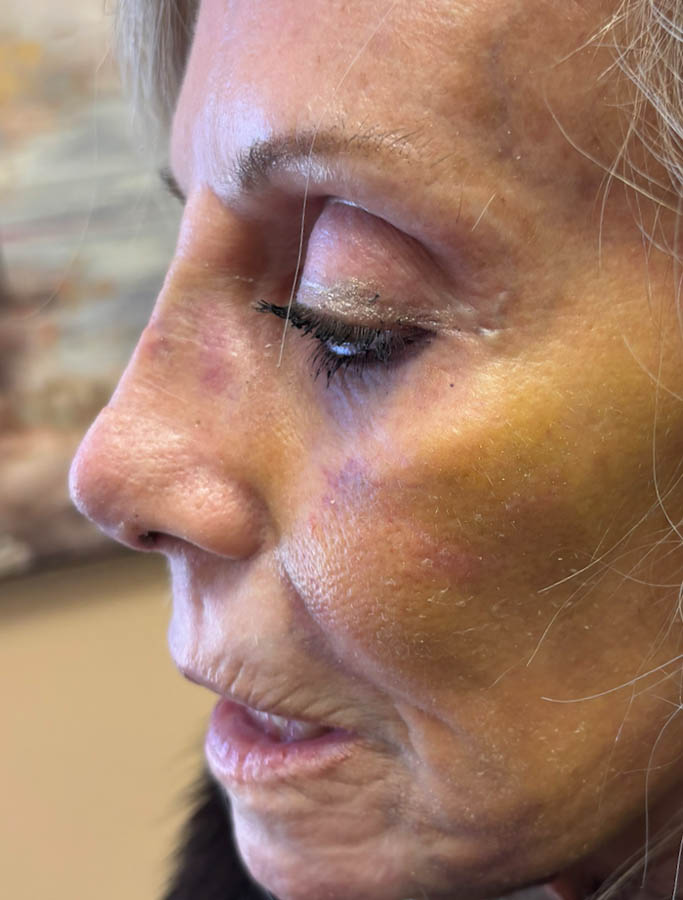 After Image: Patient Case #18682 - left-side