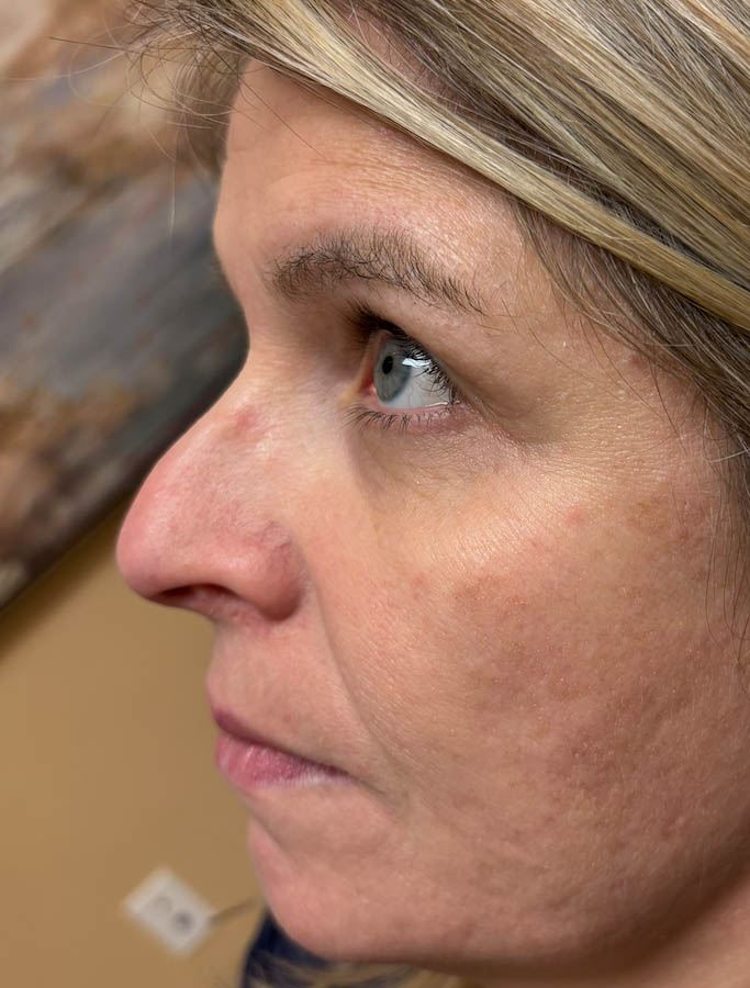 Before Image: Patient Case #18687 - left-side