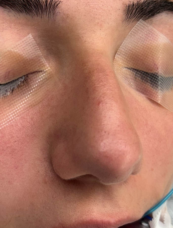 Before Image: Patient Case #18687 - right-front-oblique