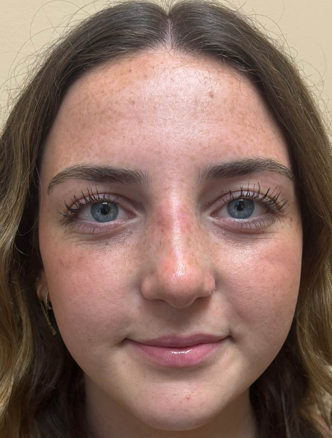 After Image: Patient Case #18897 - front