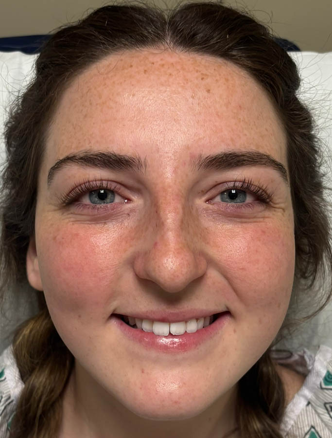 Before Image: Patient Case #18897 - front