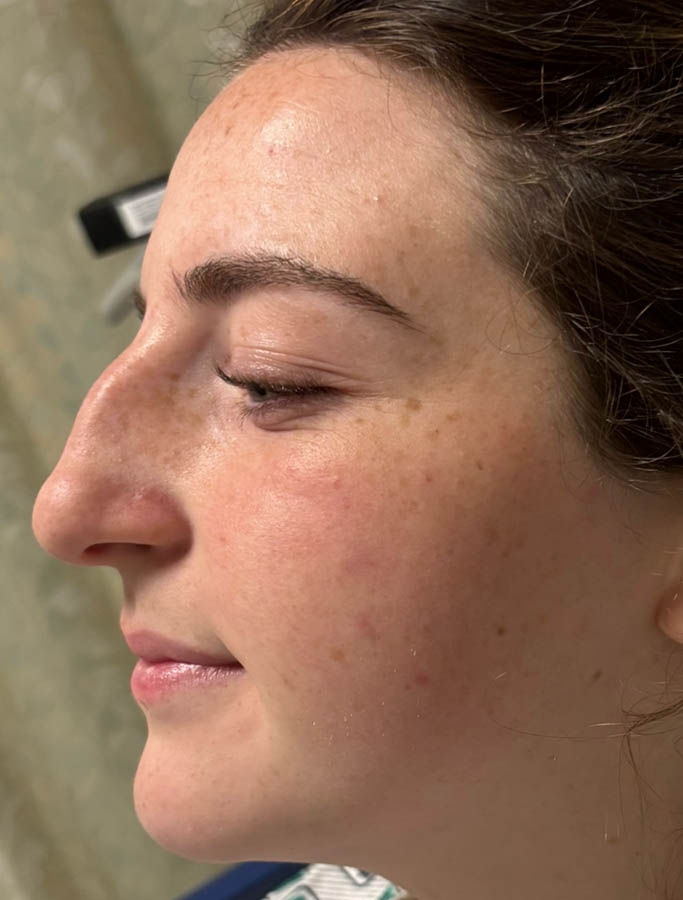 Before Image: Patient Case #18897 - left-side