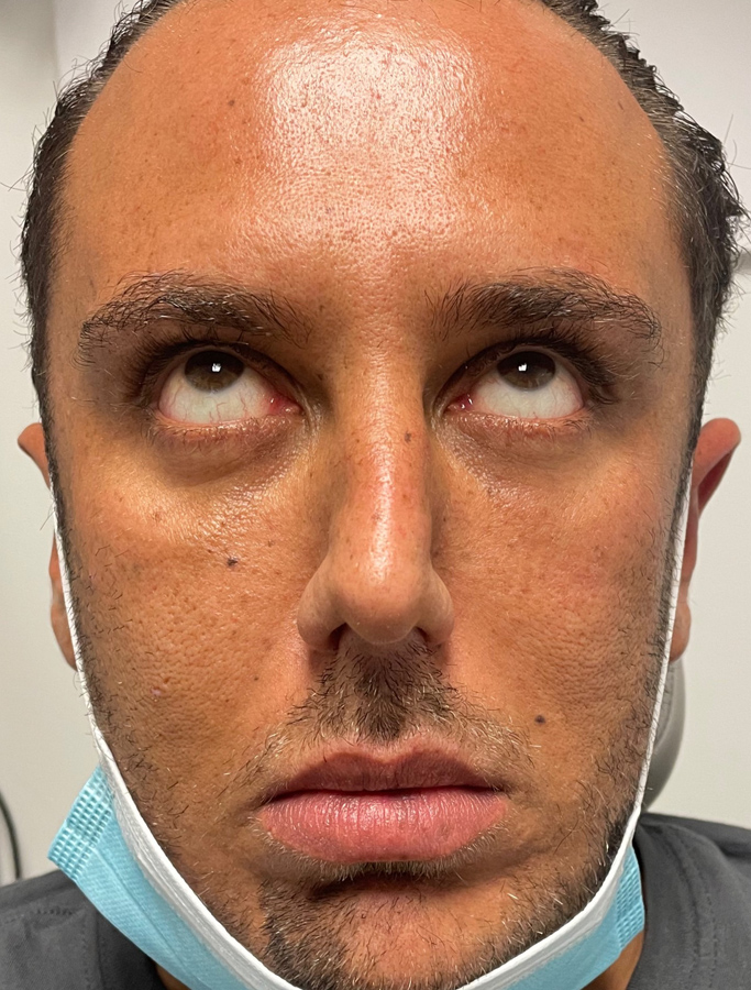 Before Image: Patient Case #1985 - front