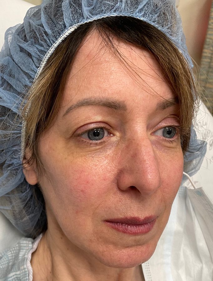 Before Image: Patient Case #1991 - right-front-oblique