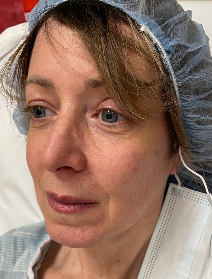 Before Image: Patient Case #1991 - left-front-oblique