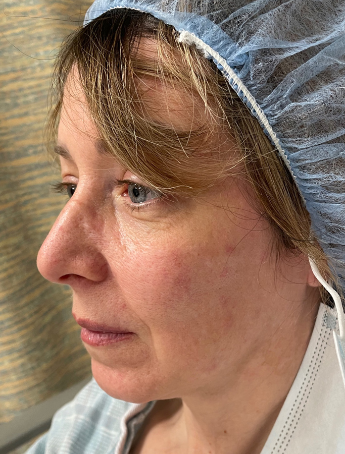 Before Image: Patient Case #1991 - left-side