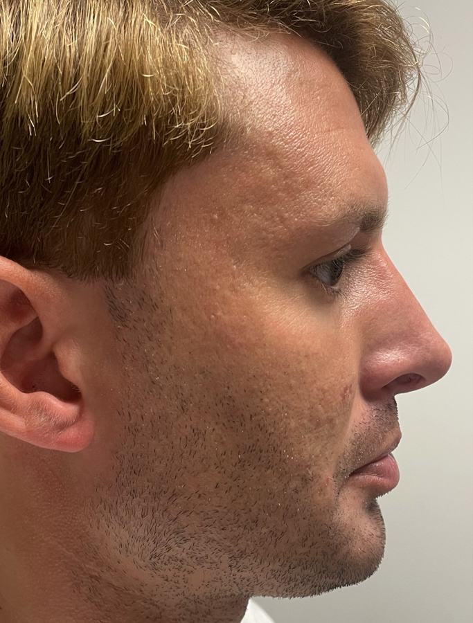 After Image: Patient Case #1992 - right-side