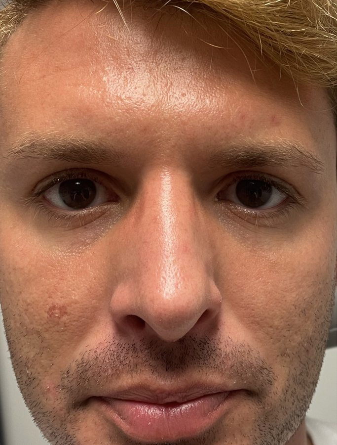 After Image: Patient Case #1992 - front