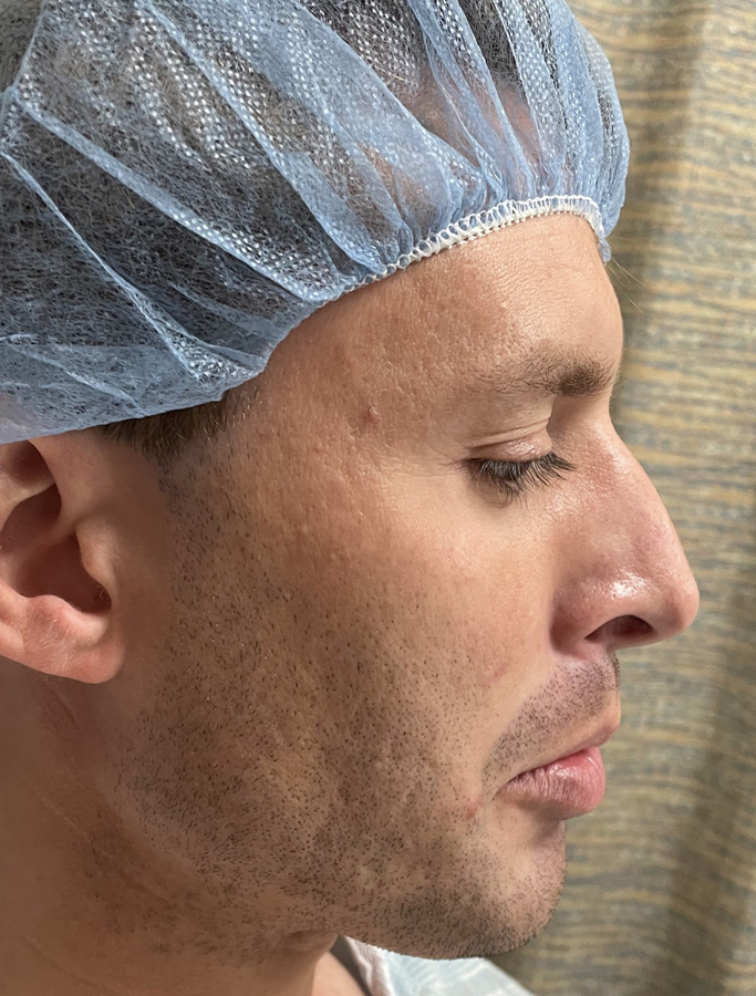 Before Image: Patient Case #1992 - right-side