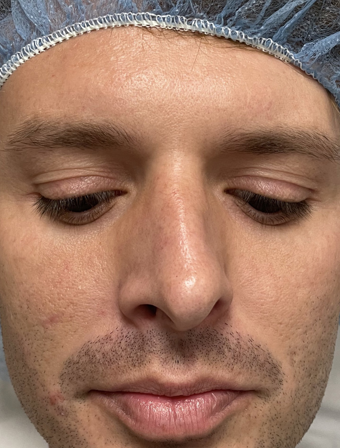 Before Image: Patient Case #1992 - front