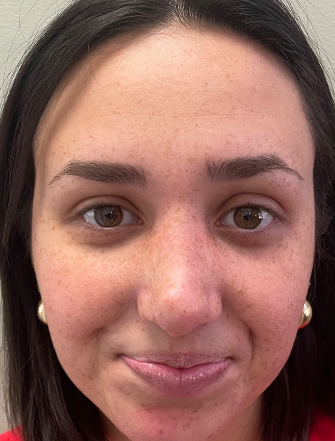 After Image: Patient Case #1994 - front