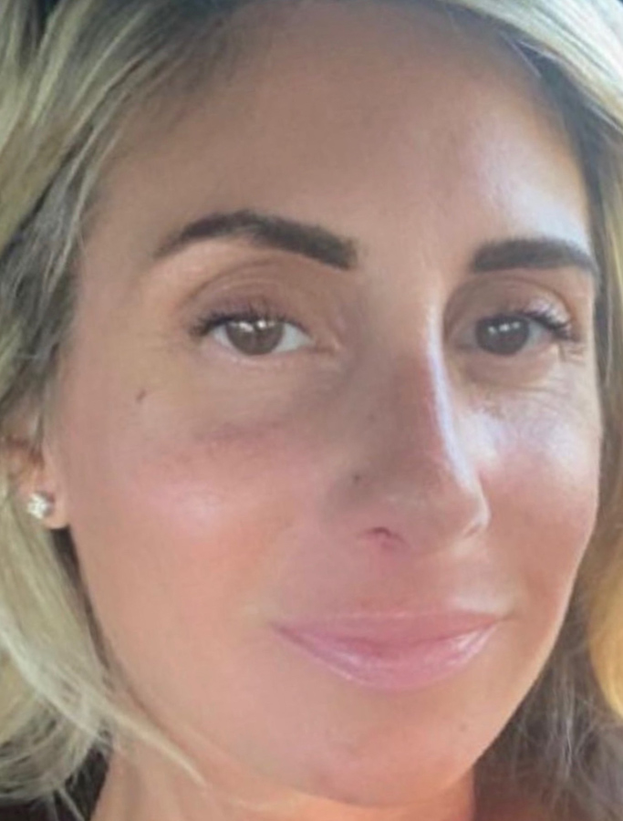 After Image: Patient Case #1996 - right-front-oblique