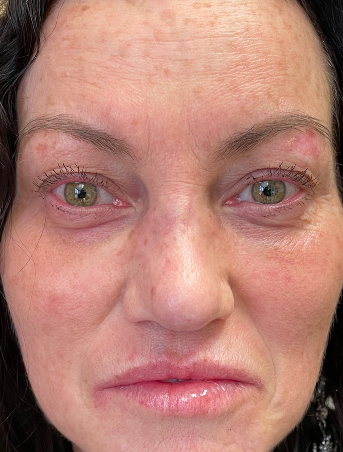 After Image: Patient Case #2031 - front