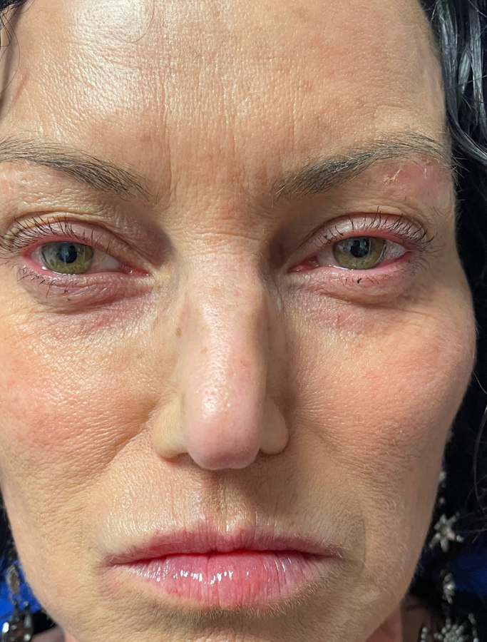 Before Image: Patient Case #2031 - front