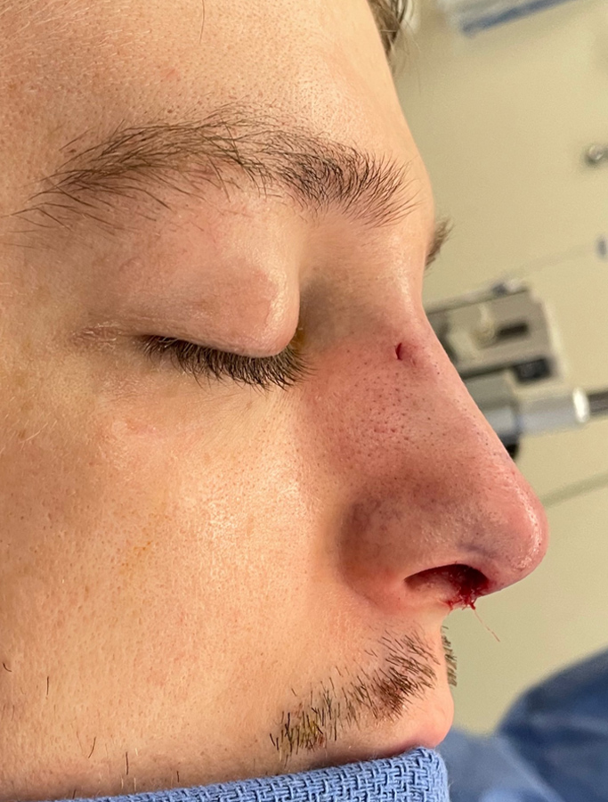 After Image: Patient Case #2033 - right-side