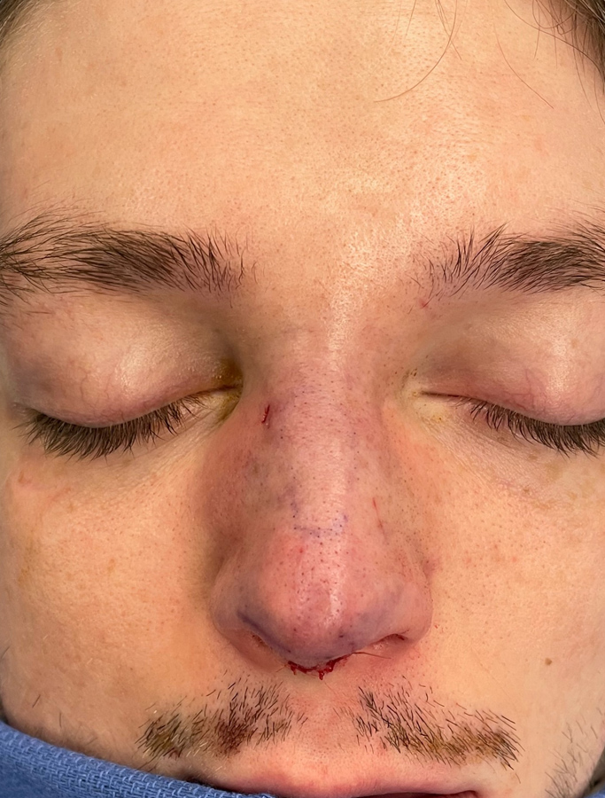 After Image: Patient Case #2033 - front