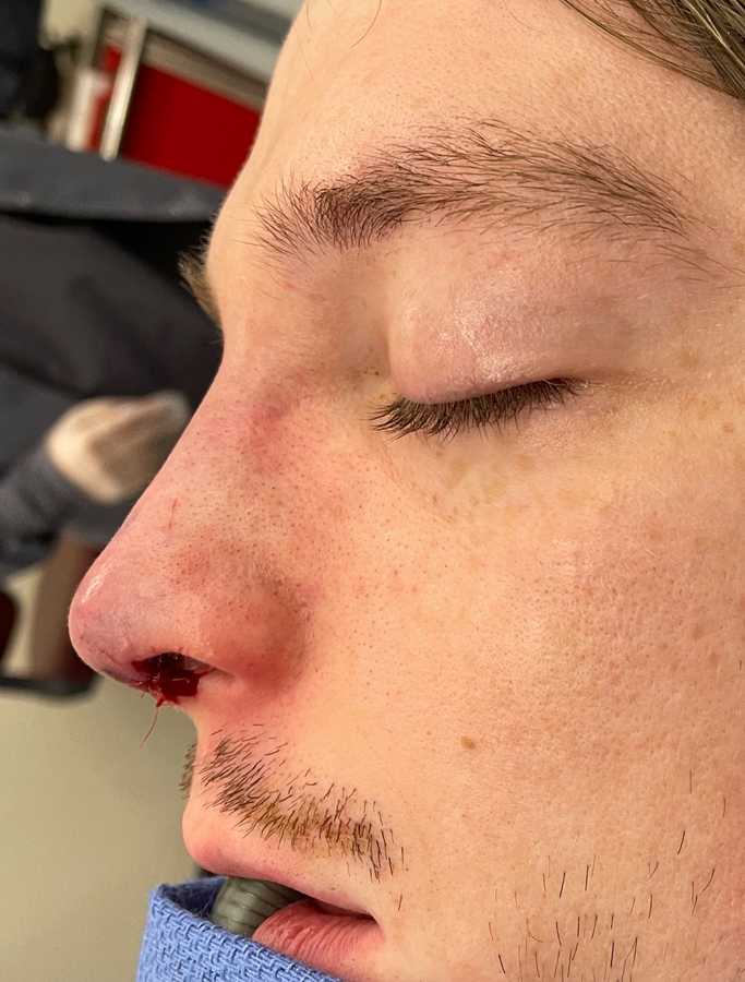 After Image: Patient Case #2033 - left-side