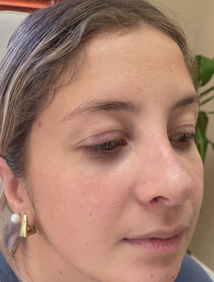 After Image: Patient Case #2034 - right-front-oblique